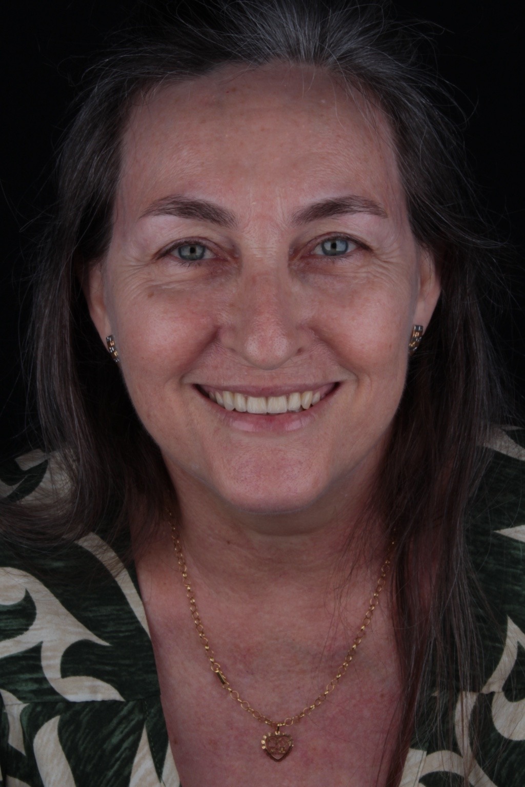Registro fotográfico de paciente sorrindo